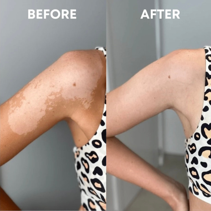 PureFormBeauty™ Exfoliating Glove