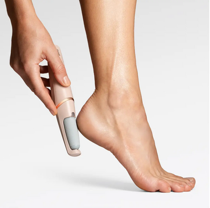 PureFormBeauty™ Callus Remover